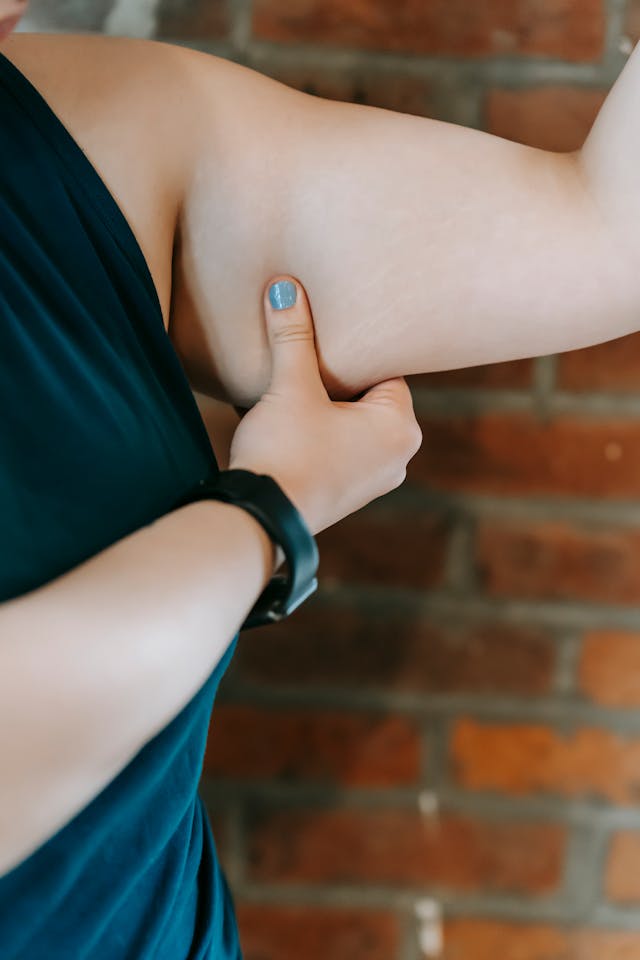 Causes of arm fat
